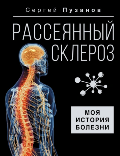 Рассеянный склероз. Моя история болезни - Сергей Пузанов - Слушать Любимую Книгу + Без Рекламы 📲 Slushat-Knigi.Com
